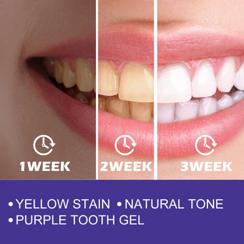 EELHOE PURPLE WHITENING TOOTHPASTE  معجون أسنان تبييض أرجواني من إيلهو